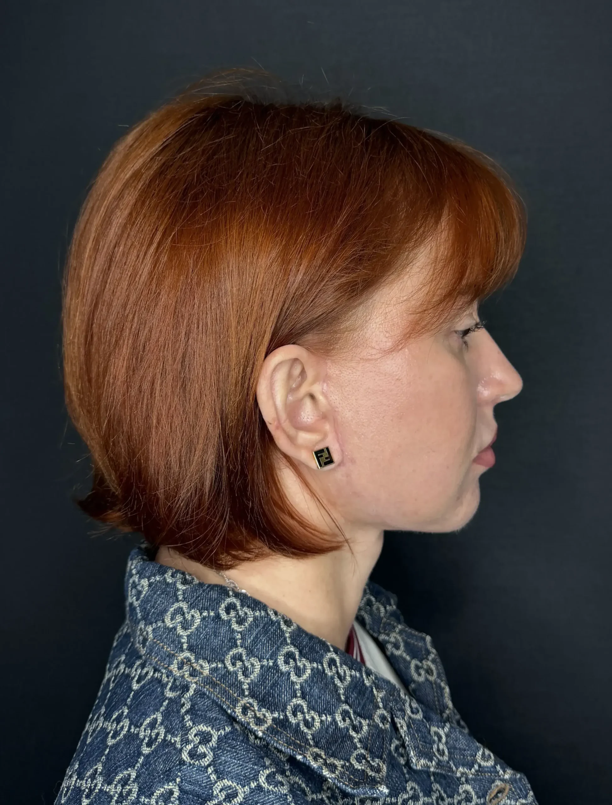 После